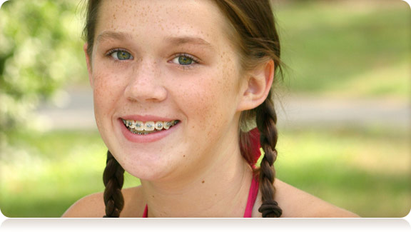 young smiling girl with braces